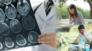 FENOMENA MENGKHAWATIRKAN: STROKE KINI MENGINTAI WARGA MUDA INDONESIA