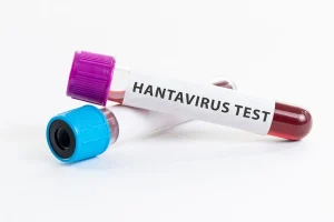 Tiga Penumpang Kapal Pesiar Tewas di Samudra Atlantik, WHO Konfirmasi Satu Kasus Virus Hanta